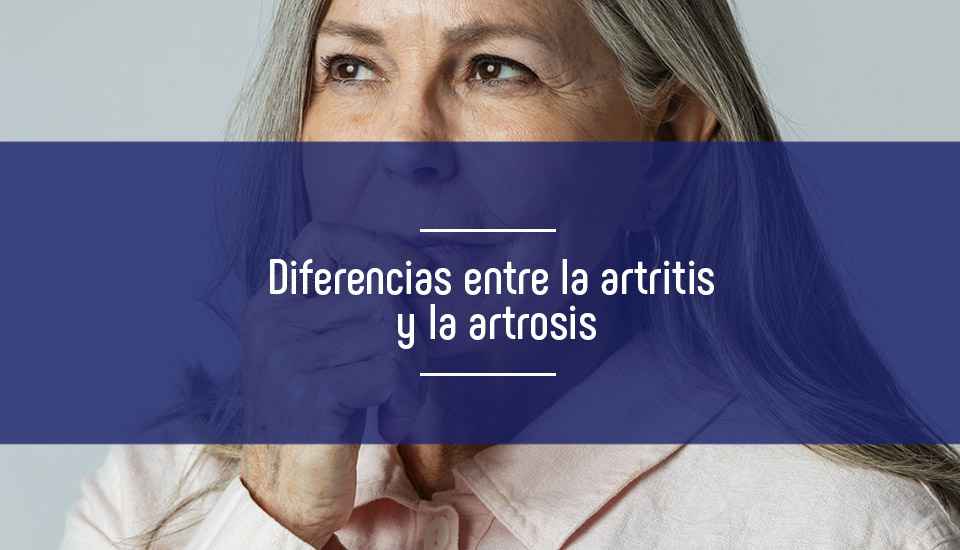 Imagen diferencias-entre-la-artrosis-y-la-artritis-prueba-desintometria-osea