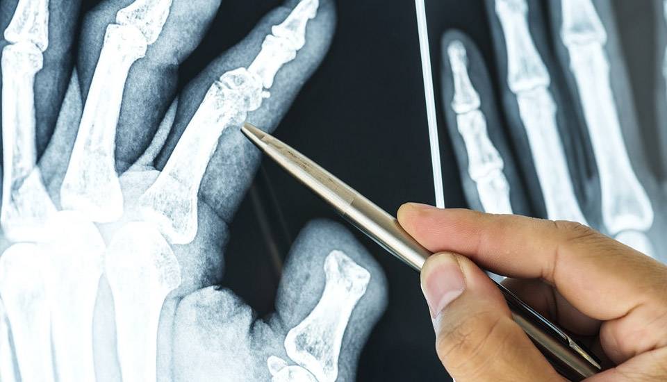 enfermedades reumaticas