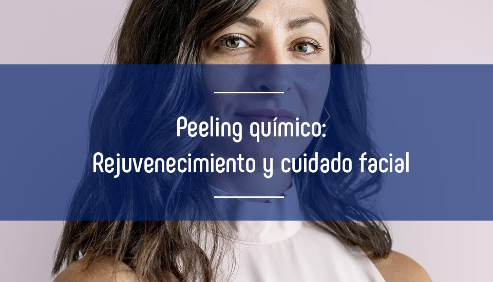 Peeling químico: rejuvenecimiento y cuidado facial
