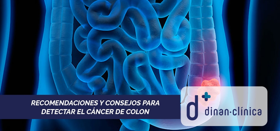 Imagen recomendaciones-y-consejos-para-detectar-el-cancer-de-colon